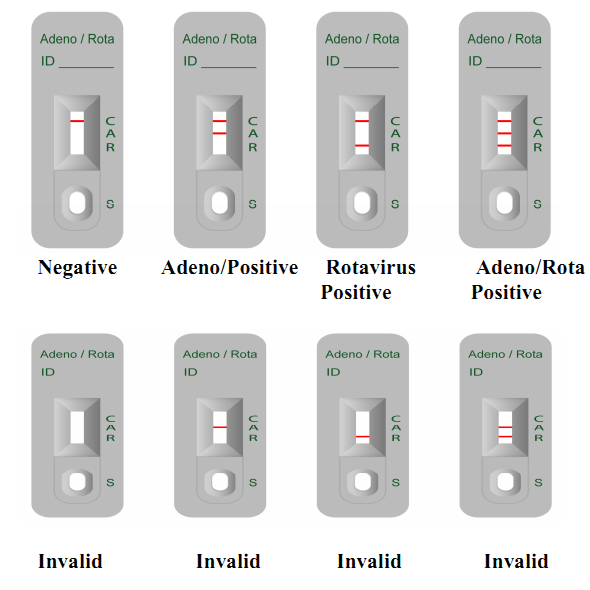 Набора анализа крови аденовируса формат 99% Аккруаси прокладки комбинированного фекального быстрый диагностический