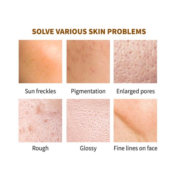 Whitening Peeling Organic Scar Removal Vitamin C Serum