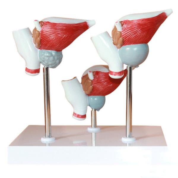 Human Anatomy PVC Simulation Human Pathology Prostate Model For Medical Educational