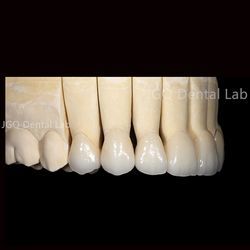 Customized Chinese Dental Lab Zirconia Teeth Precision Overall Dental Restoration