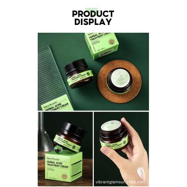 Нежная сливк 30g обработки угорь заботы кожи для кожи угорь прональной чувствительной