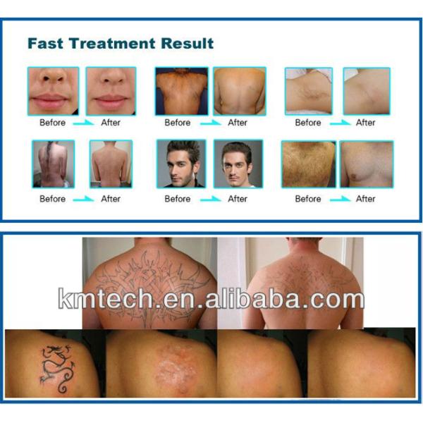 5in1 Салон / Спа IPL RF Кавитационная машина YAG Лазерная косметическая техника для ухода за кожей