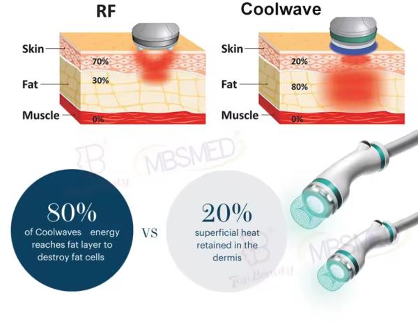 Coolwaves Body Forming Belly Fat Burn Weight Loss Slimming Beauty Machines New Technologies