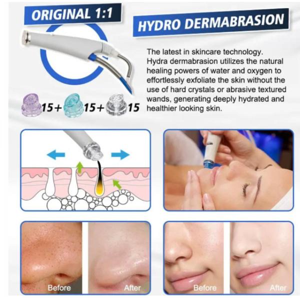 Hydra Peel Dermabrasion Facial Cleaning Beauty Machine Jet Peel Hydra Machine