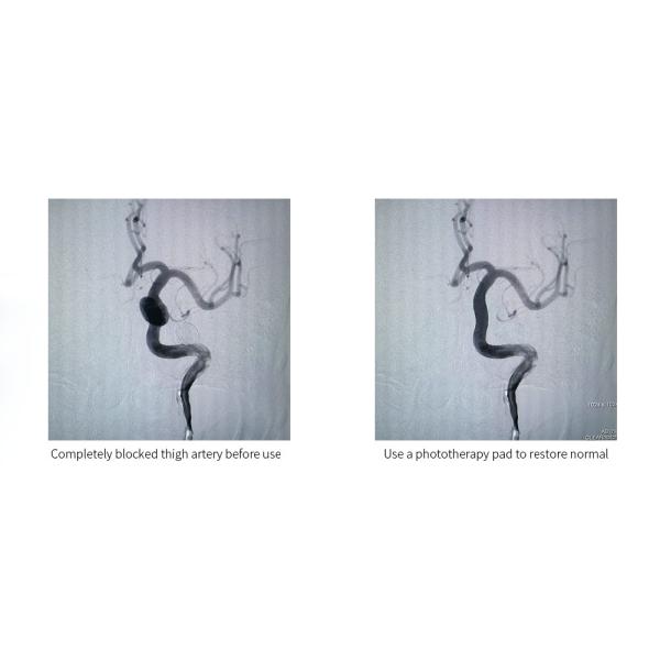 Multicolor пусковая площадка терапией света СИД облегчения боли 210pcs для клиники