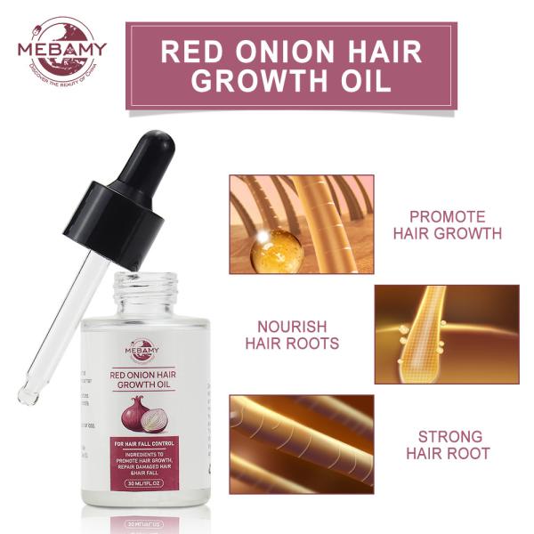 Luta por atacado do soro do crescimento de Argan Oil Herbal Anti Hair do óleo do crescimento do cabelo da cebola vermelha contra a queda de cabelo