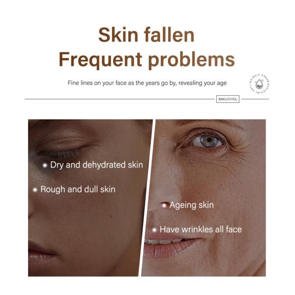 Крем против морщин, отбеливающий, отбеливающий лицо, крем для ухода за кожей 50 мл