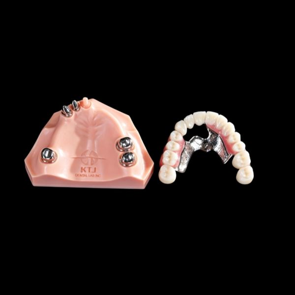 Telescope Removable Dentures Precision Attachment Overdenture Arylic