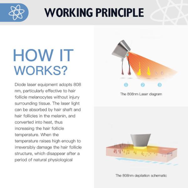 Складная машина лазера диода перманентности 808 машины удаления волос лазера Alexandrite