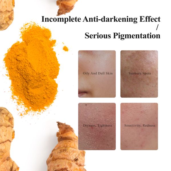 Wholesale Customization Organic White Skin Whitening Acne Toner Facial Beauty Skincare Tumeric Face Skin Toner for Face