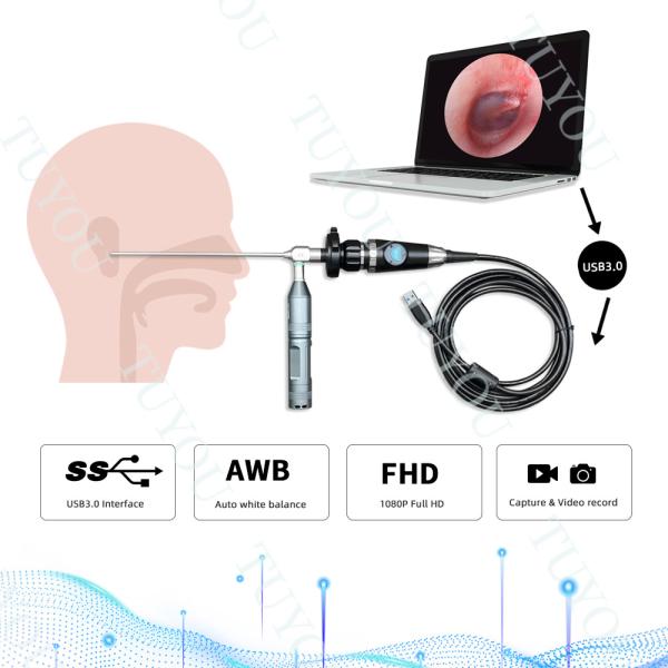 Portable USB3.0 Endoscope Handle Camera For Medical ENT Inspection
