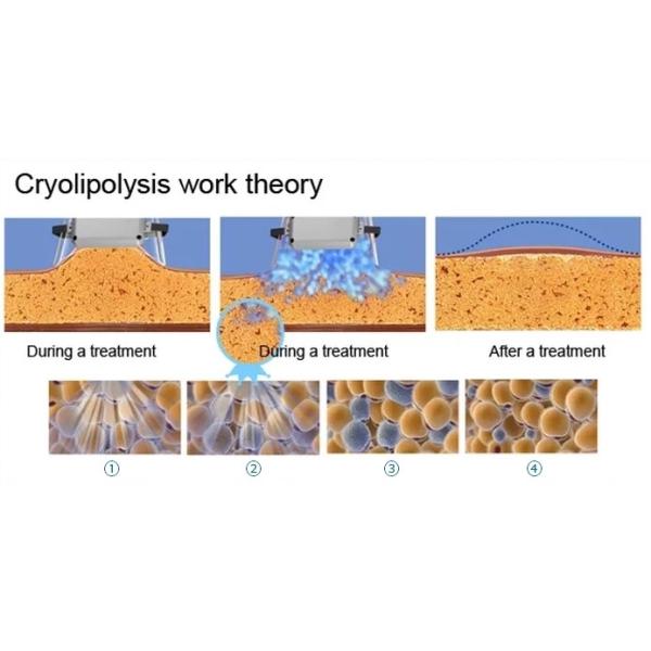 Salon Weight Loss 800VA Cryolipolysis Slimming Machine