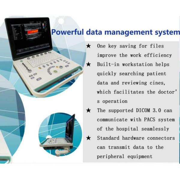 Hospital Outside 2D 3D Notebook Full Digital Color Doppler Ultrasound Diagnostic System Ultrasound Machine