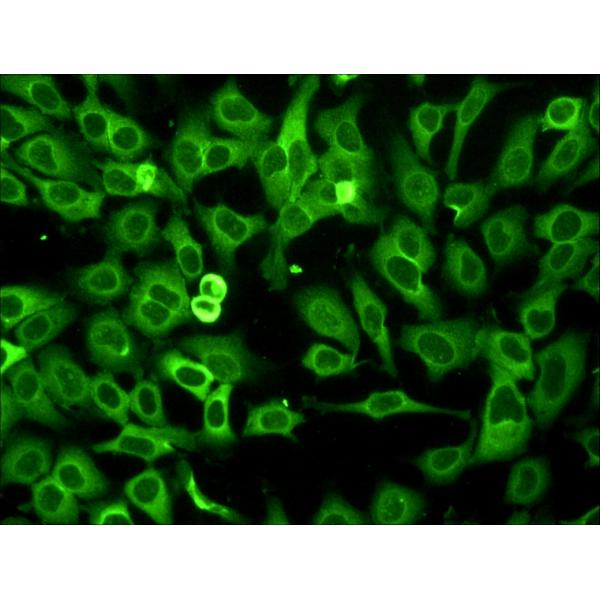 Epi fluorescent microscope for tuberculosis diagnostic