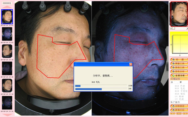 Hot sale intelligent skin analyzer machine with high resolution