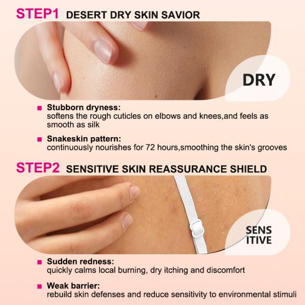 Loción hidratante para la piel para aliviar la descamación para el cuidado diario
