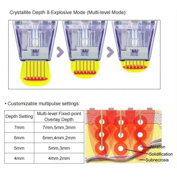 máquina fraccionaria 100V de 50W RF Microneedle a 240V