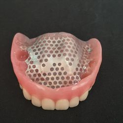 Snap in Implant Dentures Hybrid Dental Implant Restoration Screwed Retention for Dental Lab