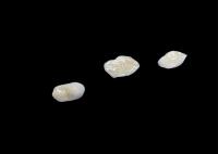 Inlays y onlays de cerámica biocompatibles diseñados para una durabilidad confortable e integración perfecta con los dientes naturales