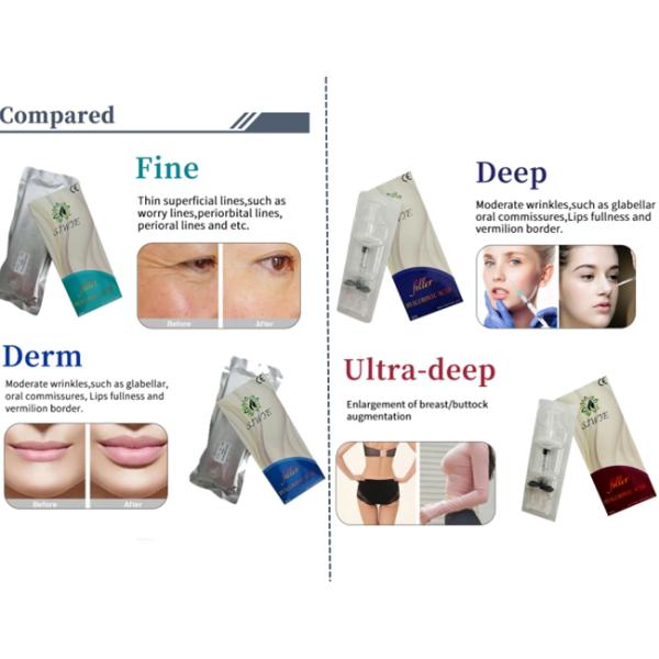 Инъекционный натриевый гиалуронат Dermal Filler Cross Linked Hyaluronic Acid для лица губы