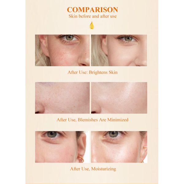 OEM Custom Beauty Products Tumeric Face Essence Liquid Manufacturer Removes Freckles Repairs Shrink Pores Whitens Skin for