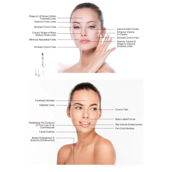 Bulk Acetylated Hydrolyzed Sodium Hyaluronate For Skin Lips Face Injection