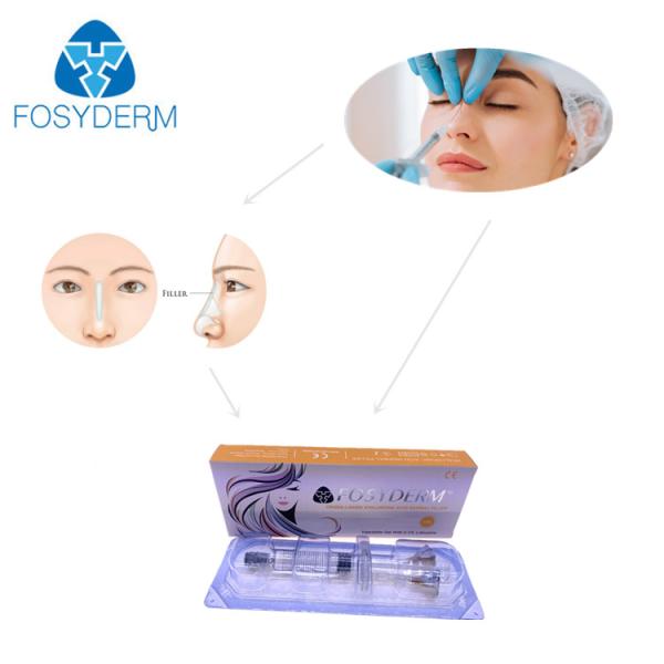 заполнитель 5ml Fosyderm Hyaluronic кисловочный дермальный для глубоких линий обнюхивает щеки Chin