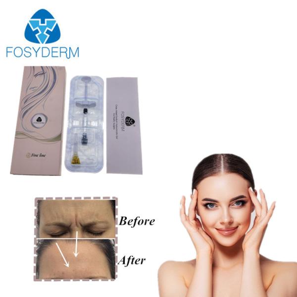 Лицевая Hyaluronic кисловочная дермальная впрыска Ha усиливающего агента губы заполнителя