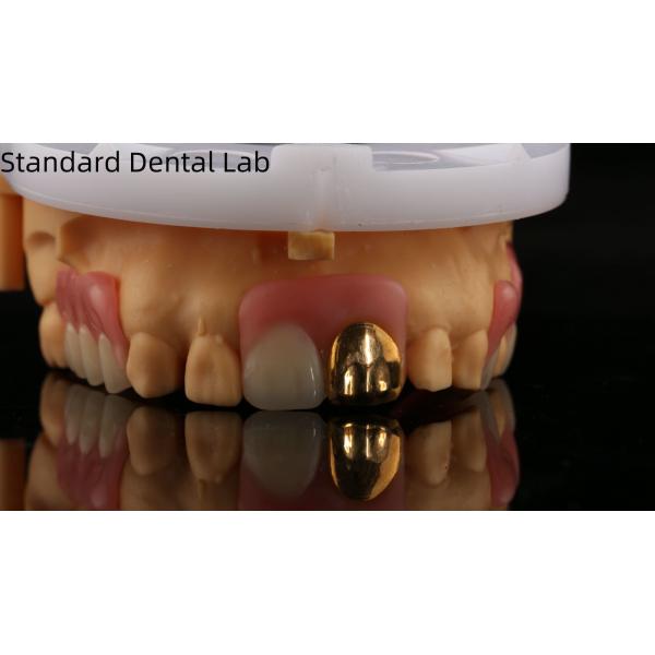 Full Acrylic Dentures With Yellow Gold Teeth/Dental Temporary Acrylic Denture Ivoclar Professional FDA Approved