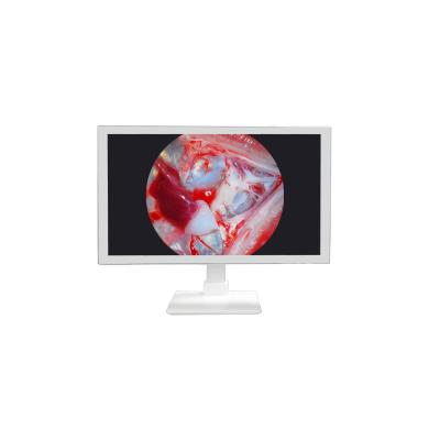 FHD Medical Equipment 22 24 27 Inch Endoscope Camera Monitor Display Full HD Medical Monitor