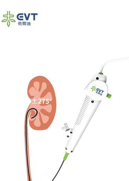 Ureteroscopio flexible desechable ultra delgado para manejo de cálculos, endoscopio desechable