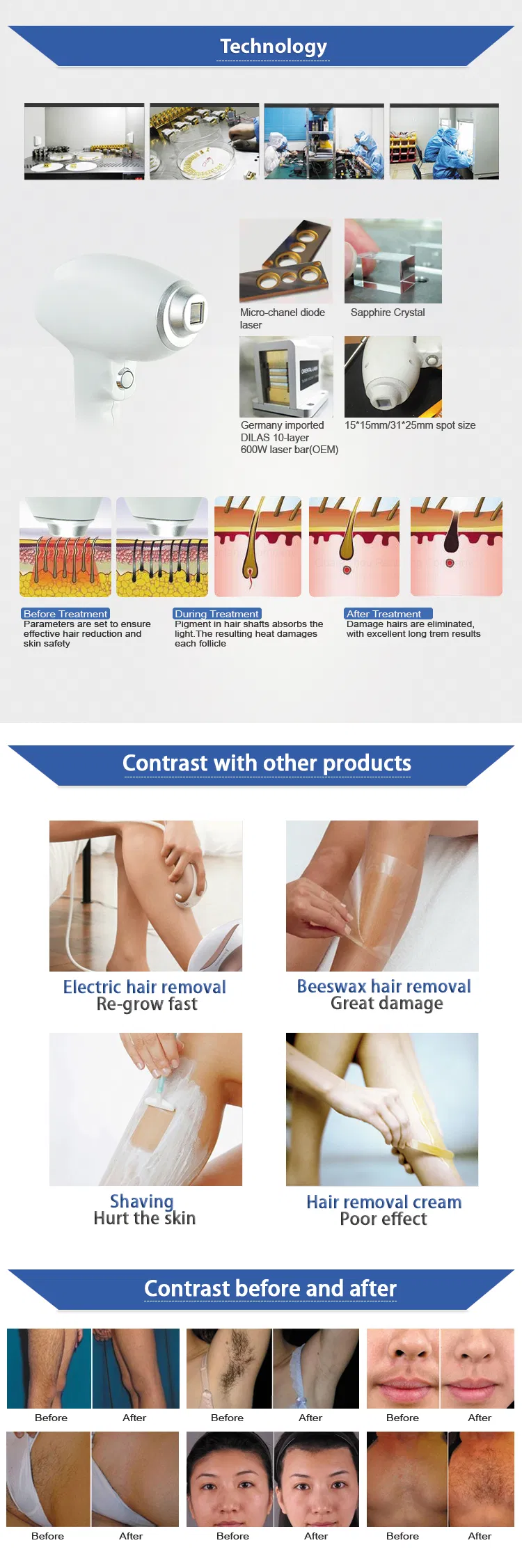 808nm Laser Diode Hair Removal Machine 300W with CE ISO9001