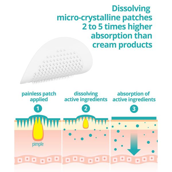 6 Counts Hydrocolloid Pimple Patches Anti Inflammatory Microneedle Acne Patches
