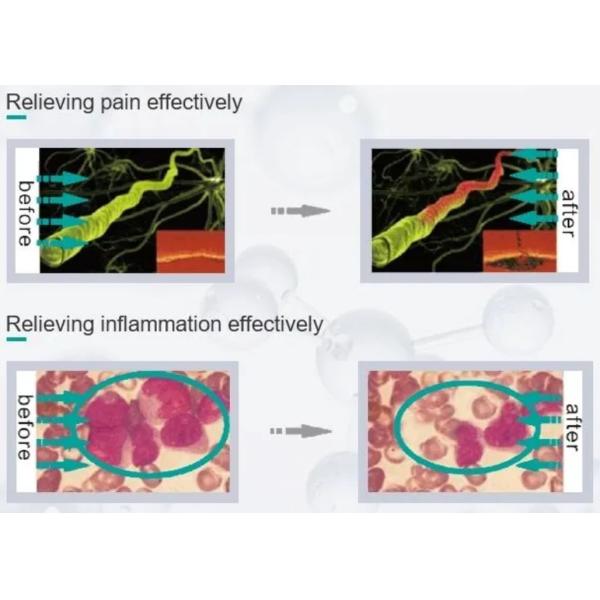 40C To 55C 2 Handles Laser Pain Relief Machine GaAlAs Semiconductor