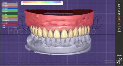 Dental Teeth Design Service With Prosthesis Planning And Oral Implant Designs