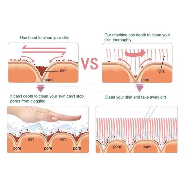 Six In One Hydrafacial Machine Multifunctional For Facial Deep Cleaning / Detoxing