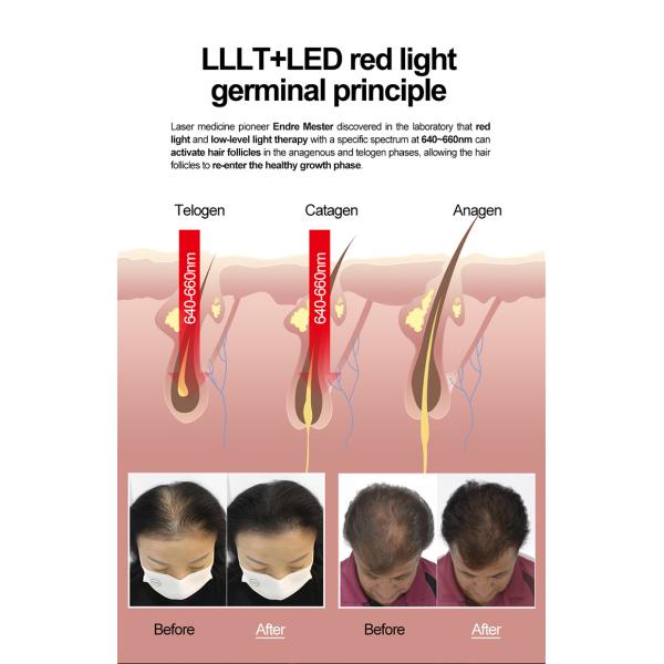 Lllt Laser Cap For Hair Regrowth