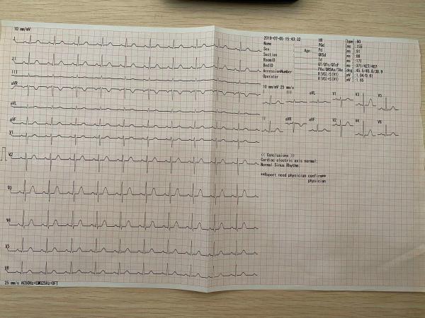 3 6 12 Channel ECG Machine Digital EKG Cardiograph for Hospital Cheap Price