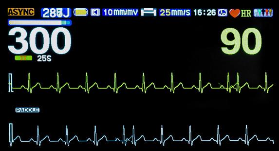 Biphasic Defibrillator Monitor Machine Medical Manual External Synchronous Asynchronous