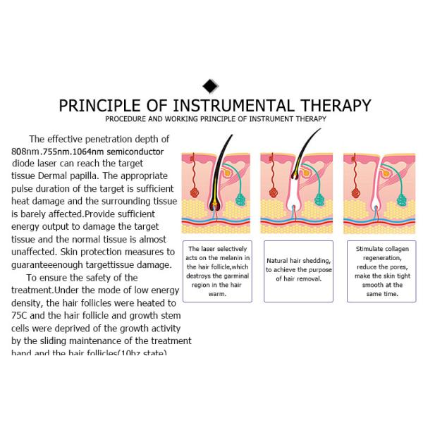 china Vertical high power new tri-wavelength depilacion equipment maquina de hair removal 810 808nm laser diodo