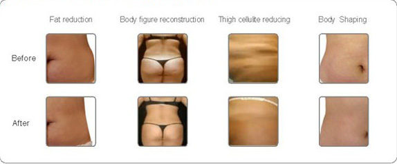 650nm - 550nm Cryolipolysis уменьшая машину для формировать тела/кожа Tigtening