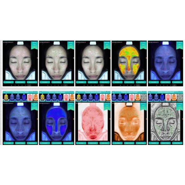 Skincare Wrinkle Pigmentation Acne Skin Analyser Machine 3D Smart Quizzes