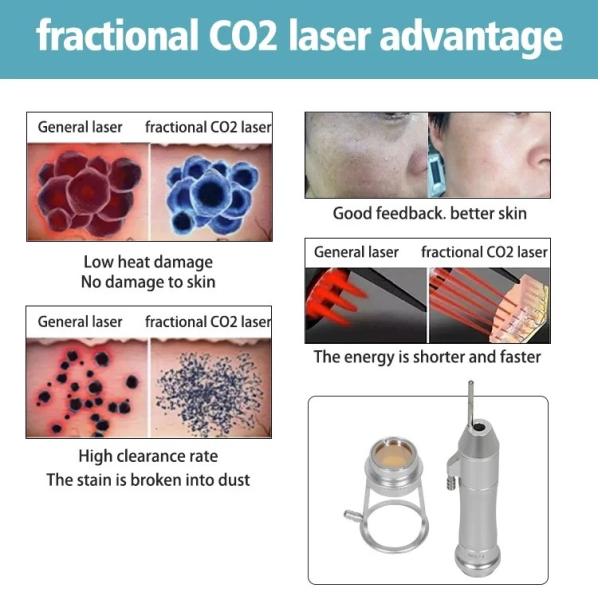 Portable 10600nm Co2 Fractional Laser Machine Pigment Removal Vaginal Tightening