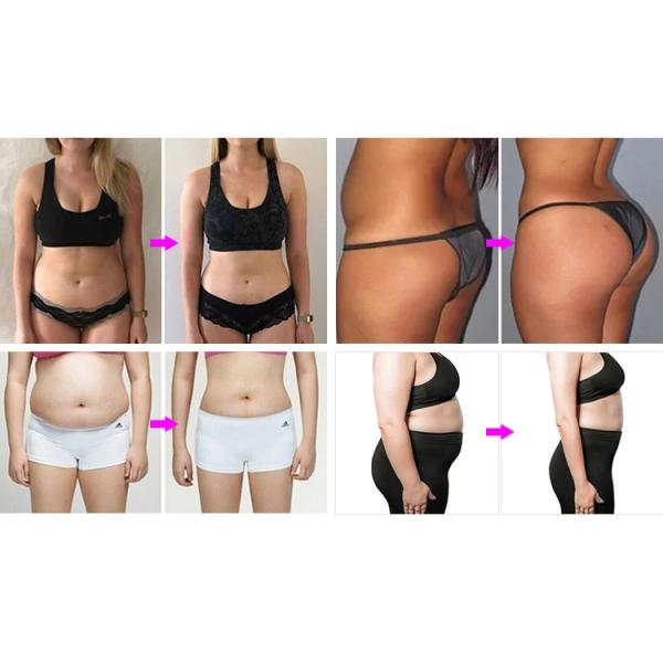 Portable 2 Handles Skin Firming Emssing Body-sculpting Machine