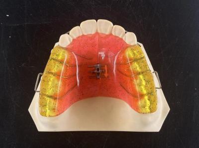Customized 2 Ways Dental Arch Expander Adjustable Orthodontic Appliance