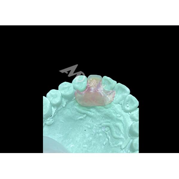 Lightweight Comfortable Nesbit Flexible Denture for Single Tooth Replacement