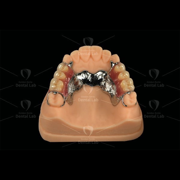 Medical Co-Cr Metal Framework Partial Color Clasp Acrylic Partial Denture