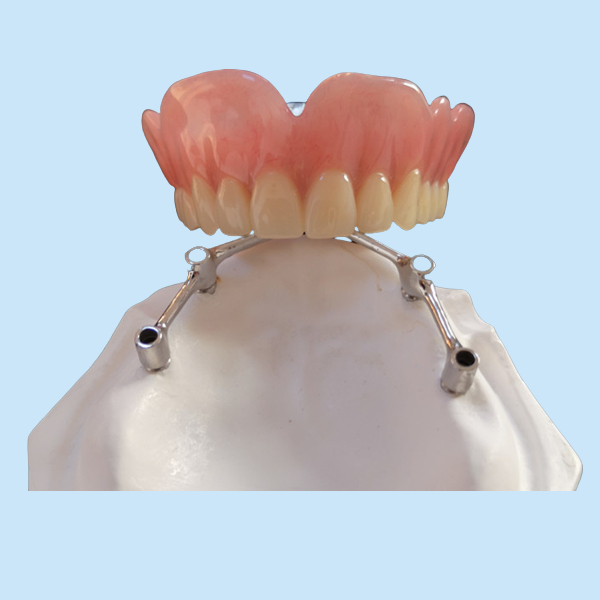 Зуб COCR имплантирует зубные имплантатов УПРАВЛЕНИЯ ПО САНИТАРНОМУ НАДЗОРУ ЗА КАЧЕСТВОМ ПИЩЕВЫХ ПРОДУКТОВ И МЕДИКАМЕНТОВ кроны с Адвокатурой титана