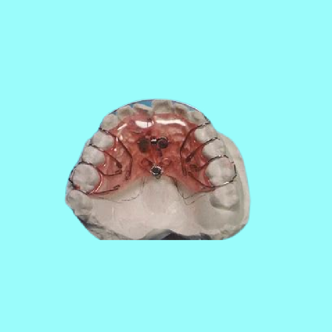 Расчалки безопасных фиксированных Aligners легкие очищая съемные фиксированные ортодонтические