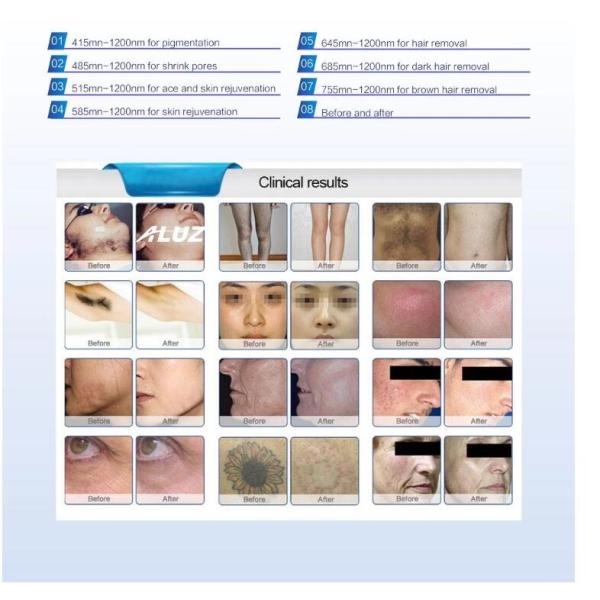 Beauty Salon Equipment Opt Shr Hair Removal Machine High Energy Output Elegant Appearance